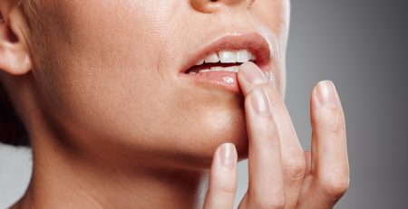cold sore prevention